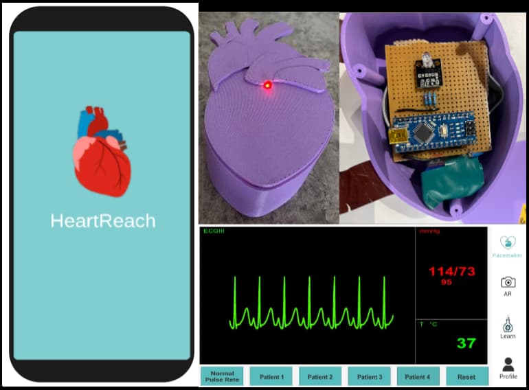 Heart Reach outreach kit screenshots and hardware